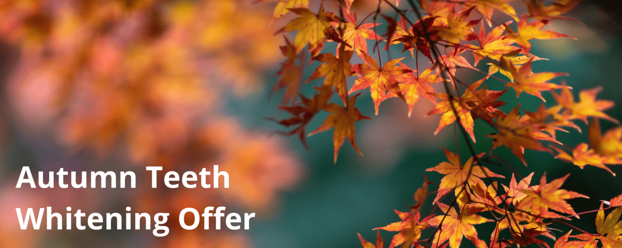 Elevate Your Smile This September! Special Offer on Teeth Whitening