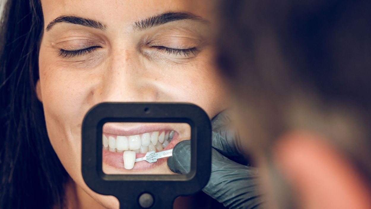 Pola Teeth Whitening in West Moors: £350 (Save £100)