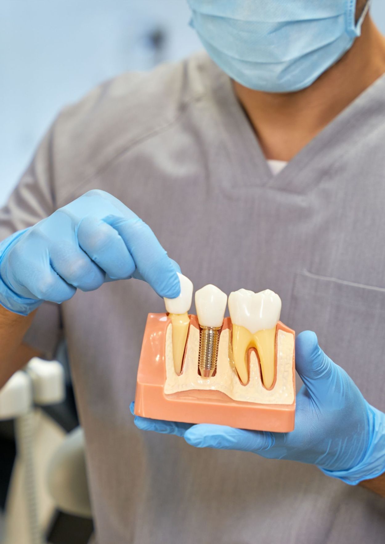 dental implants