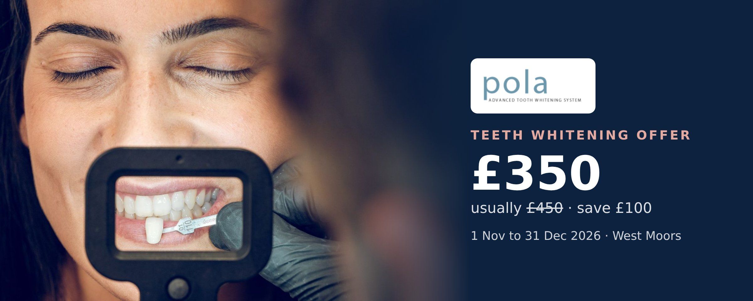 Pola Teeth Whitening in West Moors: £350 (Save £100)